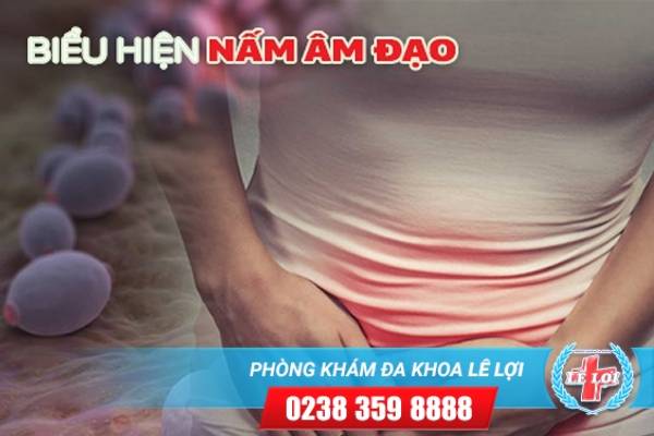 Những hình ảnh biểu hiện nấm âm đạo