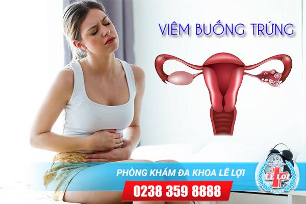 Bệnh viêm buồng trứng ở nữ giới