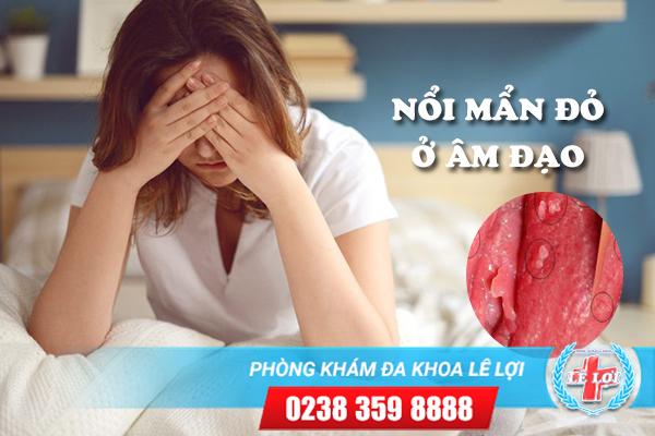 Nổi mẩn đỏ ở âm đạo