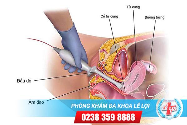 Siêu âm buồng trứng là gì?