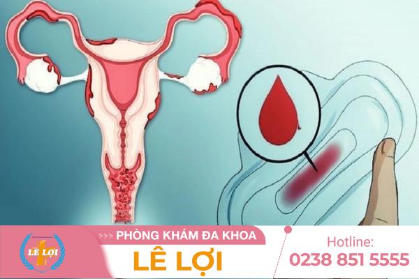 Ra-mau-nhung-khong-phai-kinh