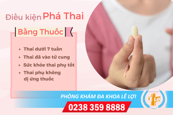 Điều Kiện